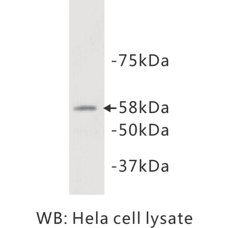 Western Blot - Anti-ALAP Antibody (BPA1007) - Antibodies.com