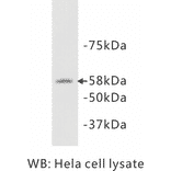 Western Blot - Anti-ALAP Antibody (BPA1007) - Antibodies.com