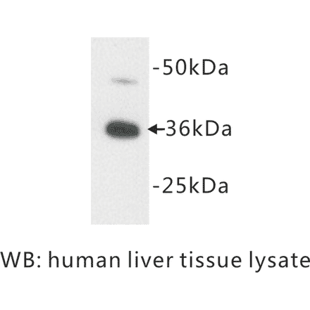 Western Blot - Anti-Apolipoprotein E Antibody (BPA1008) - Antibodies.com