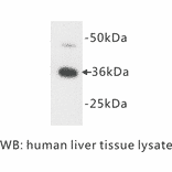 Western Blot - Anti-Apolipoprotein E Antibody (BPA1008) - Antibodies.com