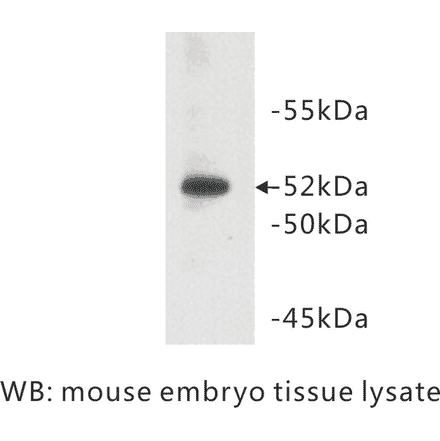 Western Blot - Anti-CD147 Antibody (BPA1010) - Antibodies.com