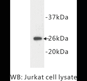 Western Blot - Anti-Bcl 2 Antibody (BPA1011) - Antibodies.com