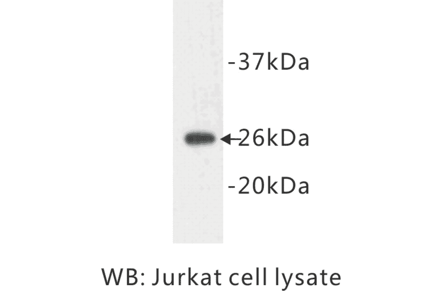 Western Blot - Anti-Bcl 2 Antibody (BPA1011) - Antibodies.com