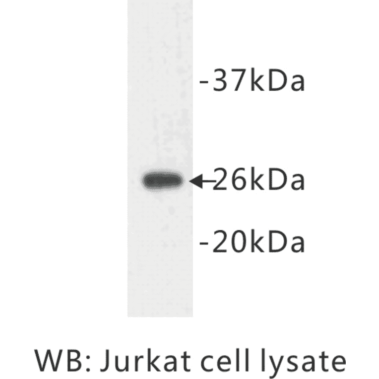 Western Blot - Anti-Bcl 2 Antibody (BPA1011) - Antibodies.com