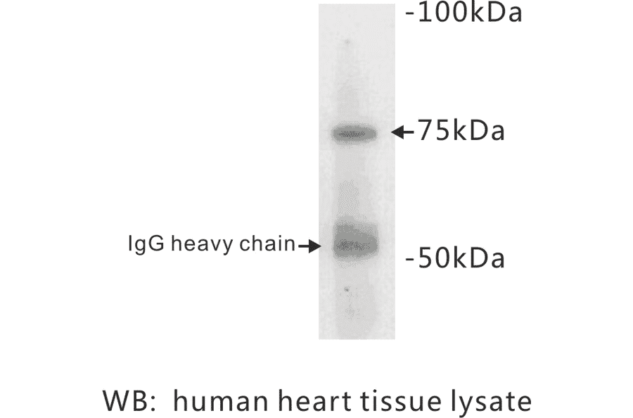 Western Blot - Anti-BMPR2 Antibody (BPA1014) - Antibodies.com