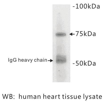 Western Blot - Anti-BMPR2 Antibody (BPA1014) - Antibodies.com