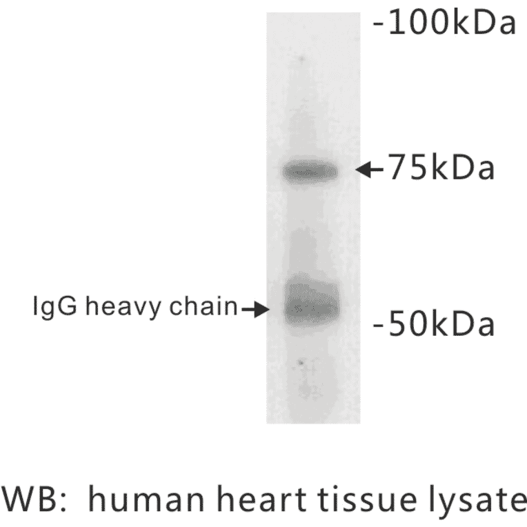 Western Blot - Anti-BMPR2 Antibody (BPA1014) - Antibodies.com