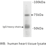 Western Blot - Anti-BMPR2 Antibody (BPA1014) - Antibodies.com