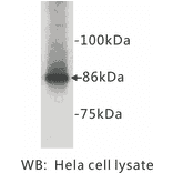 Western Blot - Anti-beta Catenin Antibody (BPA1016) - Antibodies.com