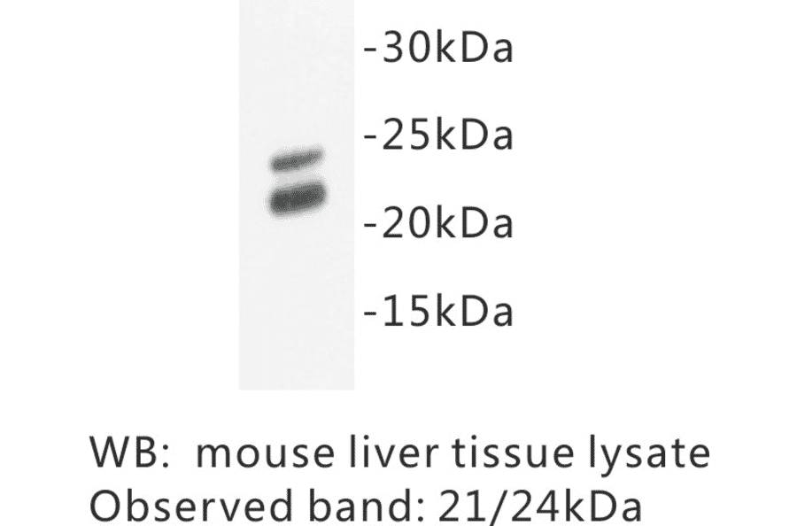 Western Blot - Anti-Caveolin 1 Antibody (BPA1017) - Antibodies.com