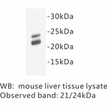 Western Blot - Anti-Caveolin 1 Antibody (BPA1017) - Antibodies.com