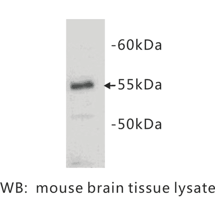 Western Blot - Anti-CD4 Antibody (BPA1020) - Antibodies.com
