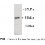 Western Blot - Anti-CD4 Antibody (BPA1020) - Antibodies.com
