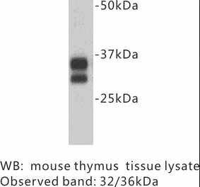 Western Blot - Anti-CD8 Antibody (BPA1021) - Antibodies.com