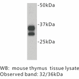 Western Blot - Anti-CD8 Antibody (BPA1021) - Antibodies.com