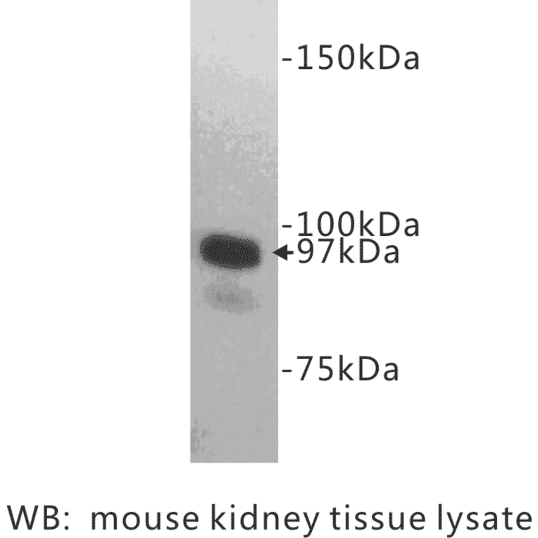 Western Blot - Anti-CD10 Antibody (BPA1023) - Antibodies.com