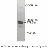 Western Blot - Anti-CD10 Antibody (BPA1023) - Antibodies.com