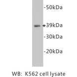 Western Blot - Anti-CD14 Antibody (BPA1024) - Antibodies.com