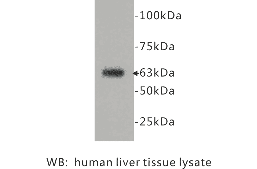 Western Blot - Anti-CD73 Antibody (BPA1027) - Antibodies.com