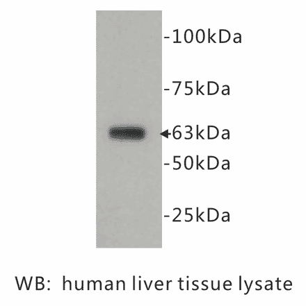 Western Blot - Anti-CD73 Antibody (BPA1027) - Antibodies.com