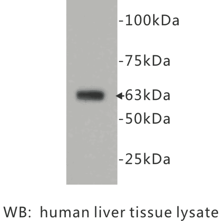 Western Blot - Anti-CD73 Antibody (BPA1027) - Antibodies.com