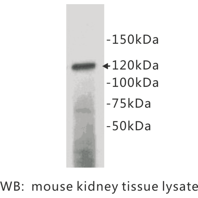 Western Blot - Anti-CD133 Antibody (BPA1031) - Antibodies.com