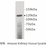 Western Blot - Anti-CD133 Antibody (BPA1031) - Antibodies.com