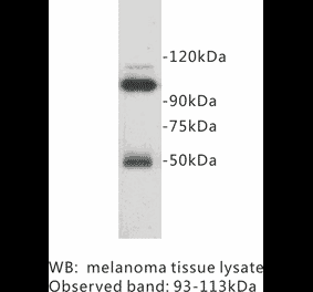 Western Blot - Anti-CD146 Antibody (BPA1032) - Antibodies.com