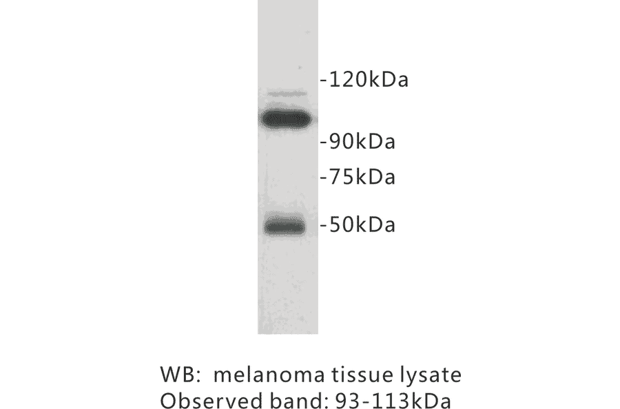Western Blot - Anti-CD146 Antibody (BPA1032) - Antibodies.com