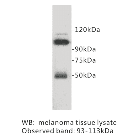 Western Blot - Anti-CD146 Antibody (BPA1032) - Antibodies.com