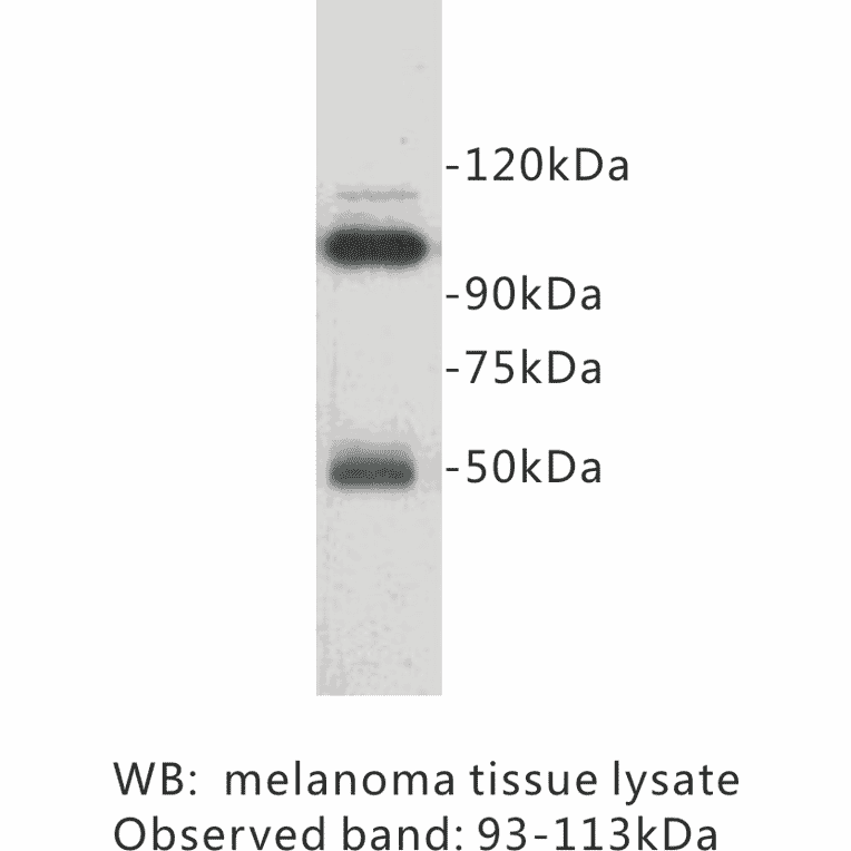 Western Blot - Anti-CD146 Antibody (BPA1032) - Antibodies.com