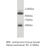 Western Blot - Anti-CD146 Antibody (BPA1032) - Antibodies.com