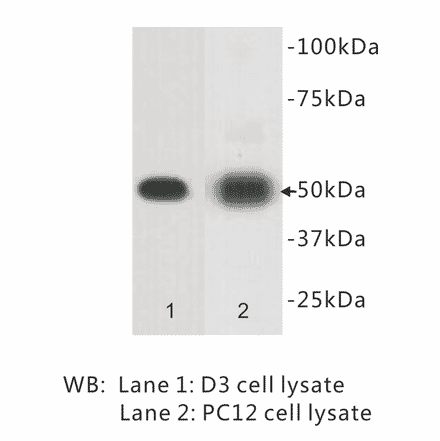 Western Blot - Anti-CD271 Antibody (BPA1033) - Antibodies.com