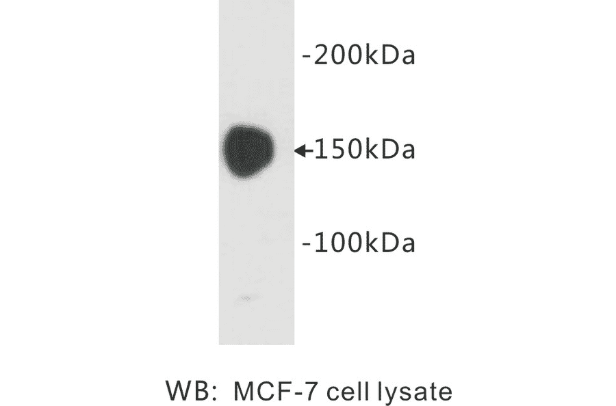 Western Blot - Anti-Carcinoembryonic Antigen Antibody (BPA1034) - Antibodies.com