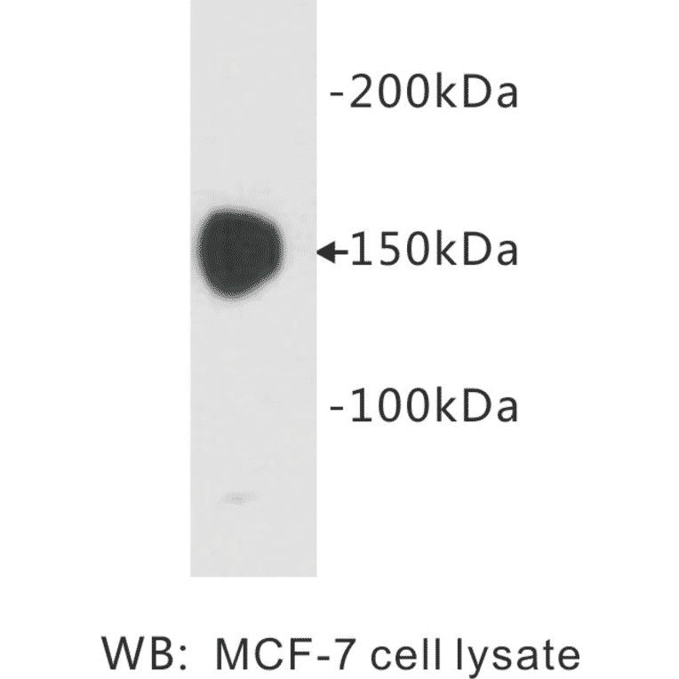 Western Blot - Anti-Carcinoembryonic Antigen Antibody (BPA1034) - Antibodies.com