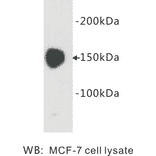 Western Blot - Anti-Carcinoembryonic Antigen Antibody (BPA1034) - Antibodies.com