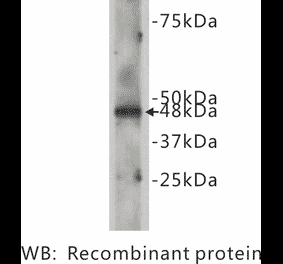 Western Blot - Anti-CELSR2 Antibody (BPA1035) - Antibodies.com