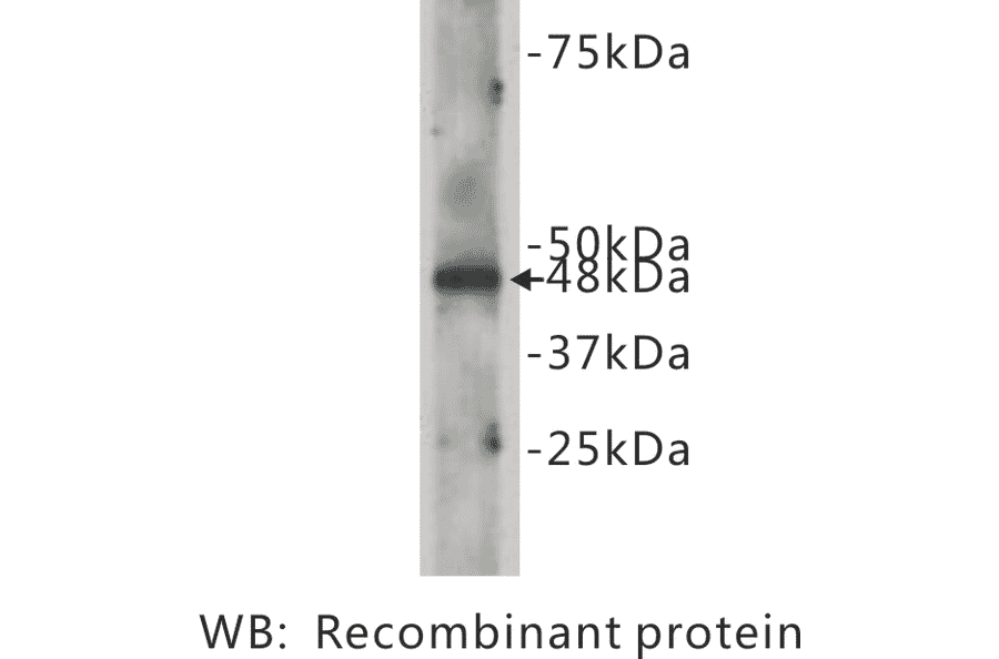 Western Blot - Anti-CELSR2 Antibody (BPA1035) - Antibodies.com