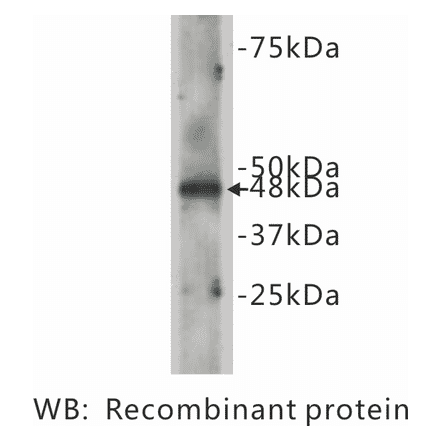 Western Blot - Anti-CELSR2 Antibody (BPA1035) - Antibodies.com