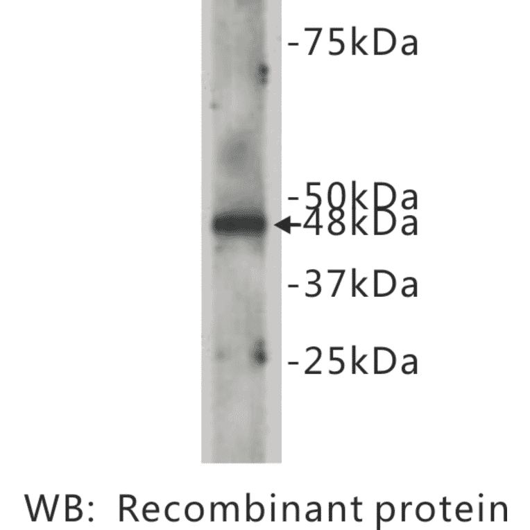 Western Blot - Anti-CELSR2 Antibody (BPA1035) - Antibodies.com