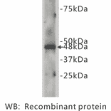 Western Blot - Anti-CELSR2 Antibody (BPA1035) - Antibodies.com