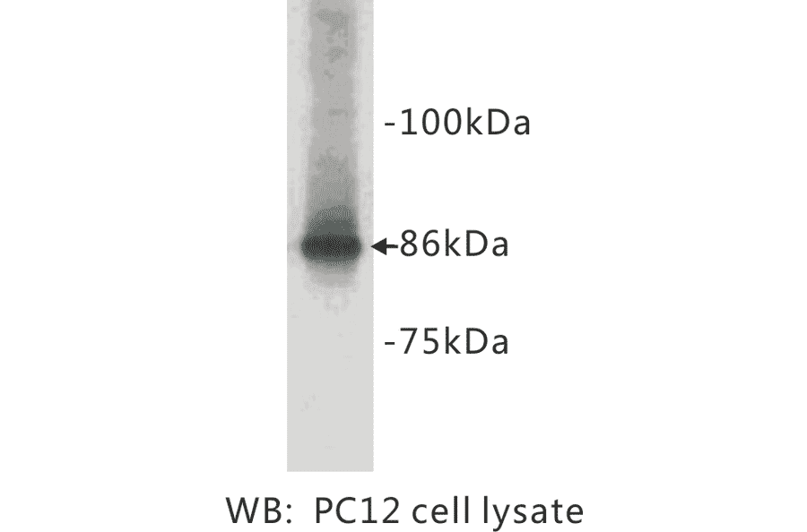 Western Blot - Anti-Chromogranin A Antibody (BPA1036) - Antibodies.com