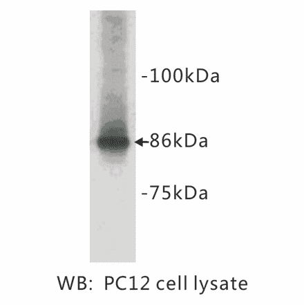 Western Blot - Anti-Chromogranin A Antibody (BPA1036) - Antibodies.com