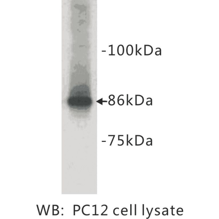 Western Blot - Anti-Chromogranin A Antibody (BPA1036) - Antibodies.com