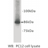 Western Blot - Anti-Chromogranin A Antibody (BPA1036) - Antibodies.com