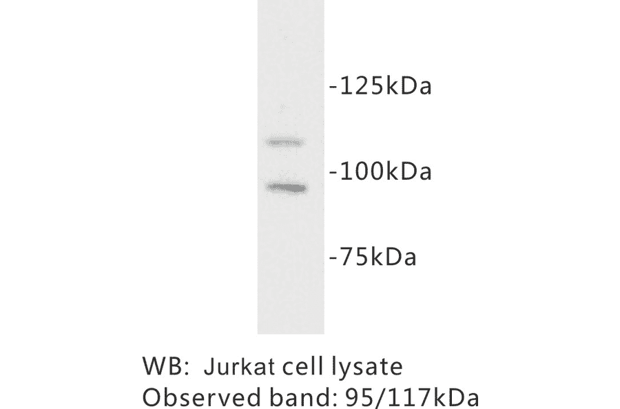 Western Blot - Anti-c Kit Antibody (BPA1037) - Antibodies.com
