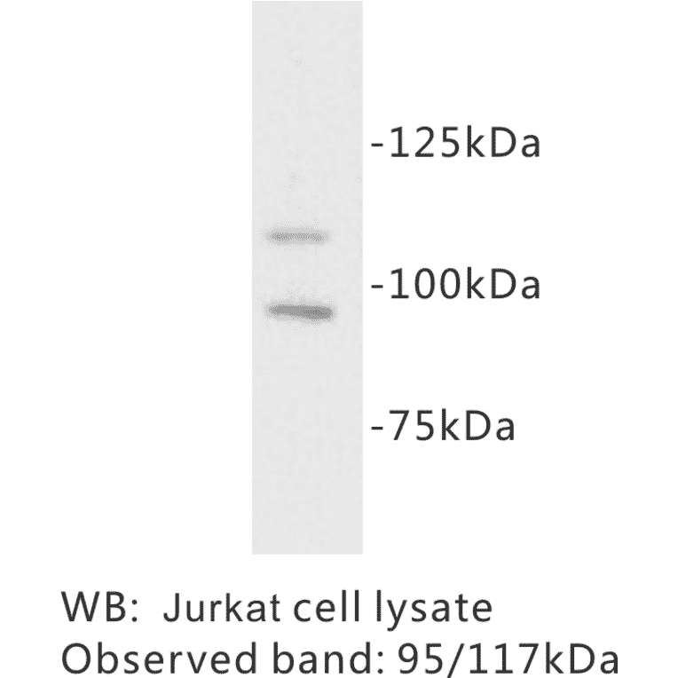 Western Blot - Anti-c Kit Antibody (BPA1037) - Antibodies.com