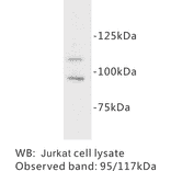 Western Blot - Anti-c Kit Antibody (BPA1037) - Antibodies.com