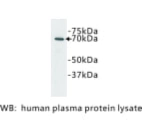 Western Blot - Anti-Complement C3 Antibody (BPA1038) - Antibodies.com