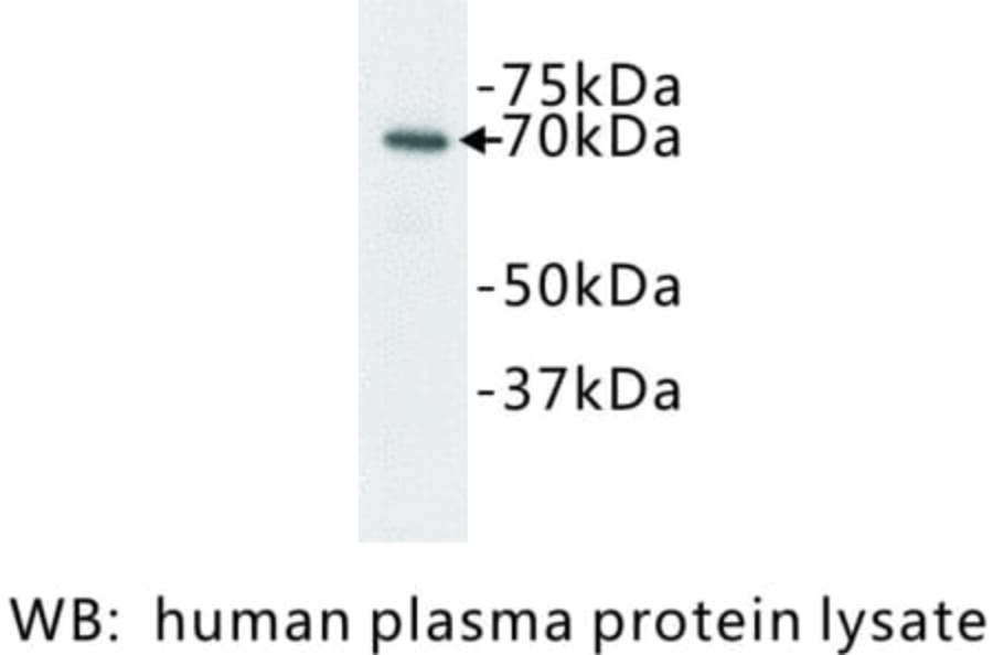 Western Blot - Anti-Complement C3 Antibody (BPA1038) - Antibodies.com